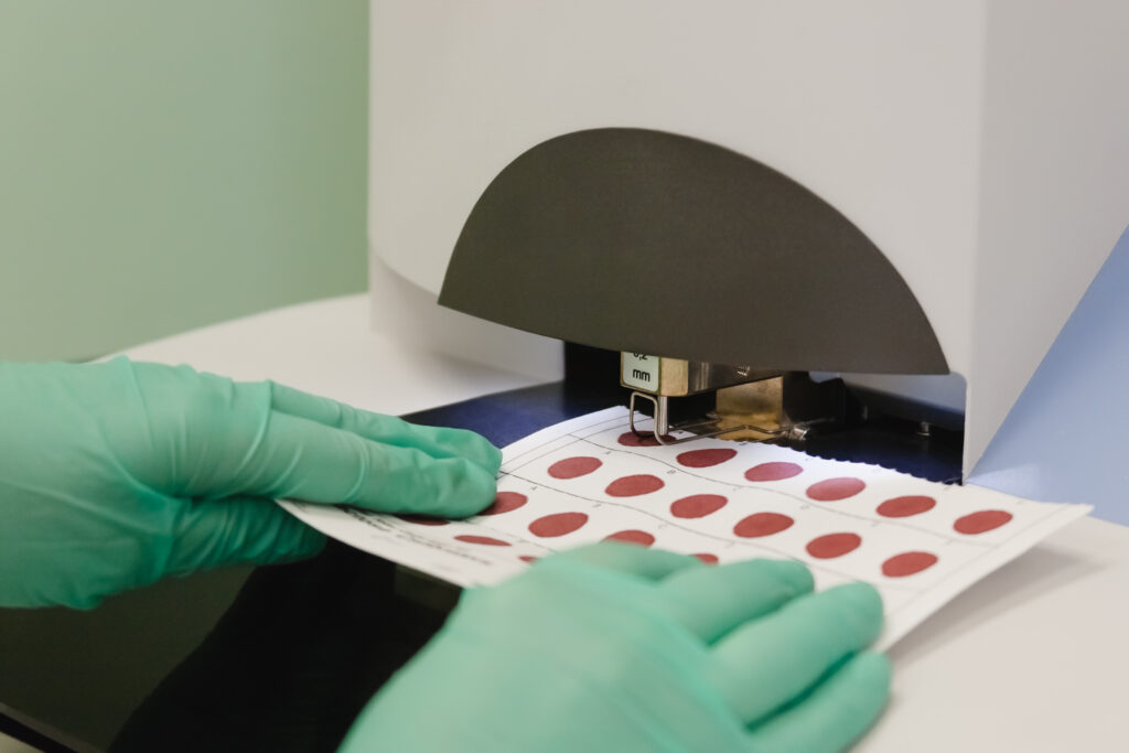 Image of lab machine using dried blood spot sheet for testing.